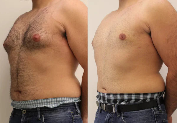 مكمل طبيعي لزيادة القوةالبدنية و  تقليل مظهر الترهل فالصدر